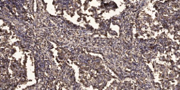 a03250 1 ubr1 primary antibodies ihc testing 1