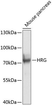 Western blot analysis of extracts of mouse pancreas, using HRG antibody  at 1:1000 dilution