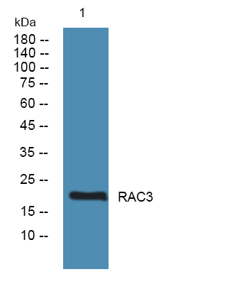 Western blot analysis of lysates from A431 cells, primary antibody was diluted at 1:1000, 4°over night