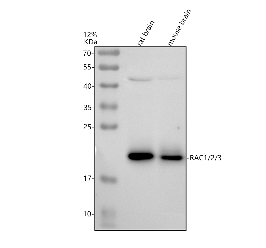 Western blot analysis of RAC1/2/3 using anti-RAC1/2/3 antibody (A03252-2)