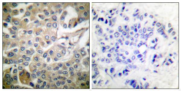 a03252 rac1 primary antibodies ihc testing 1