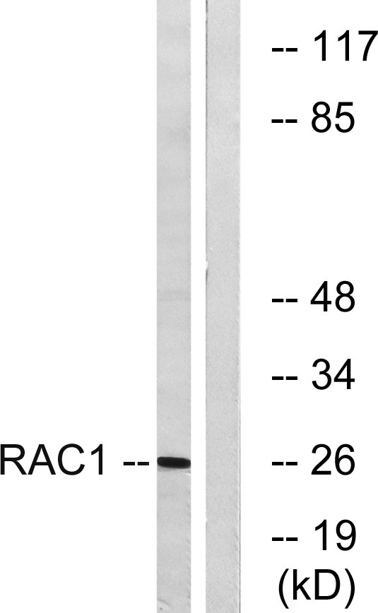 a03252 rac1 primary antibodies wb testing 4