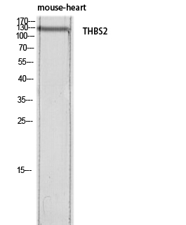 Western blot analysis of mouse-heart lysis using THBS2 antibody