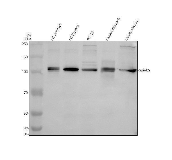 Western blot analysis of SPINK5 using anti-SPINK5 antibody (A03254-2)
