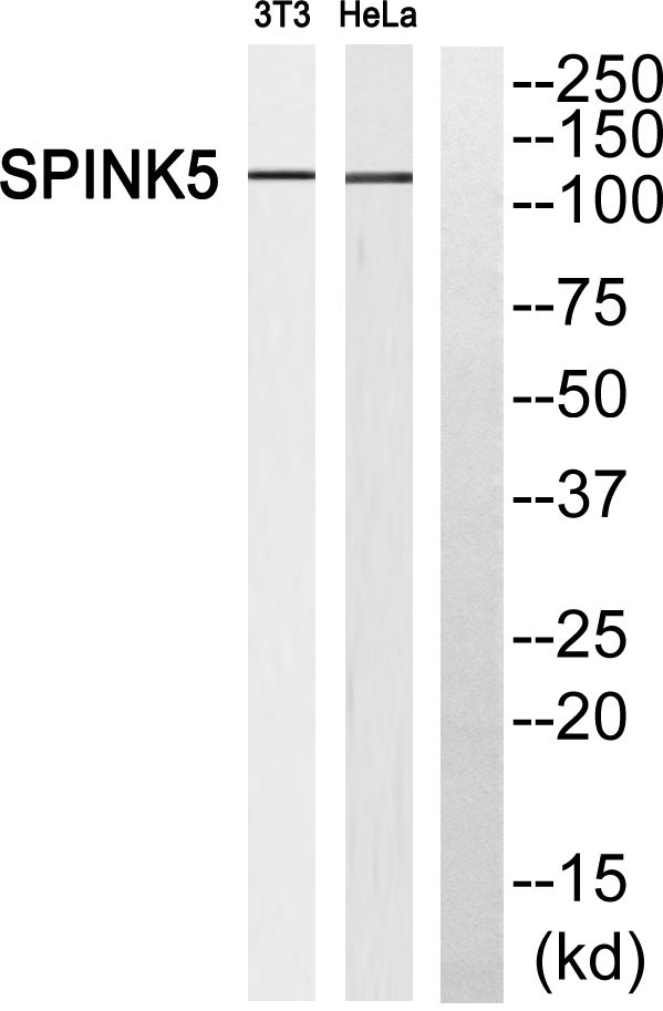 Western blot analysis of SPINK5 Antibody