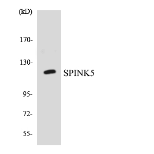 Western blot analysis of the lysates from COLO205 cells using SPINK5 antibody