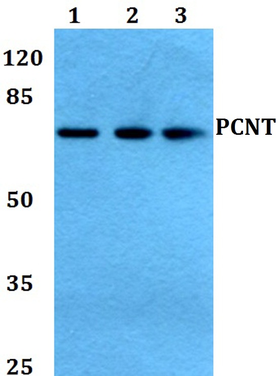Western blot (WB) analysis of PCNT polyclonal antibody at 1:500 dilution
Lane1:HEK293T whole cell lysate
Lane2:NIH-3T3 whole cell lysate
Lane3:H9C2 whole cell lysate