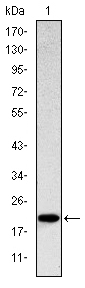 Western Blot analysis using CD94 Monoclonal Antibody against recombinant protein