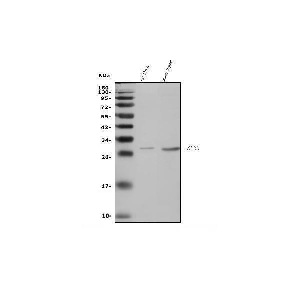  Western blot analysis of Klrd1/CD94 using anti-Klrd1/CD94 antibody (A03257-3)