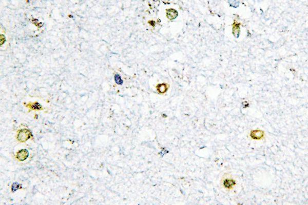 a03258 2 trim24 primary antiboties ihc testing 2