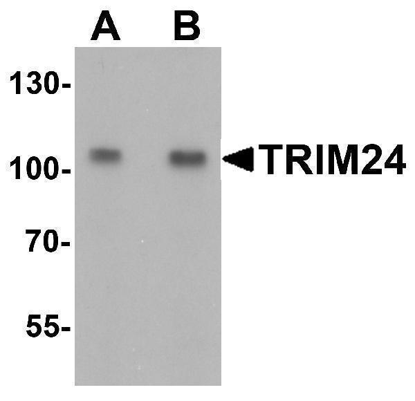 a03258 trim24 primary antibodies wb testing 1