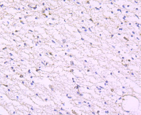 Immunohistochemical analysis of paraffin-embedded human brain tissue using anti-Glucose Transporter GLUT3 antibody