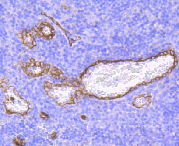 Immunohistochemical analysis of paraffin-embedded human tonsil tissue using anti-Claudin 5 antibody