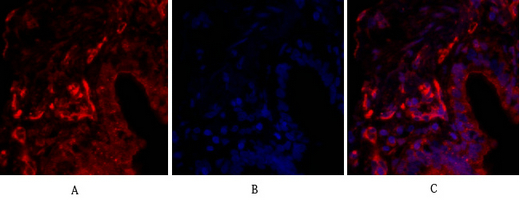a03260 cldn5 primary antibodies if testing 10