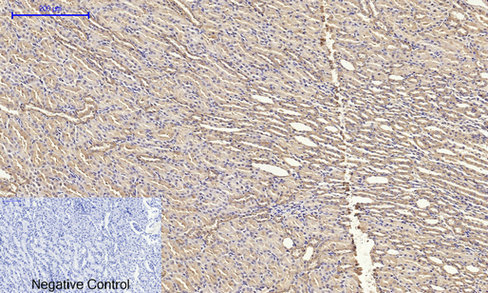 a03260 cldn5 primary antibodies ihc testing 6