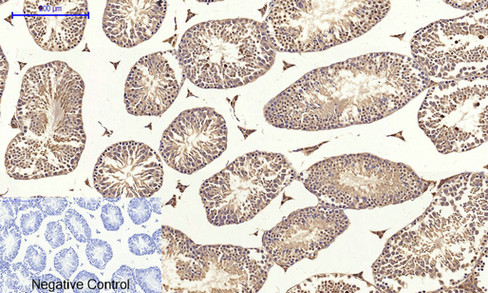 a03260 cldn5 primary antibodies ihc testing 7
