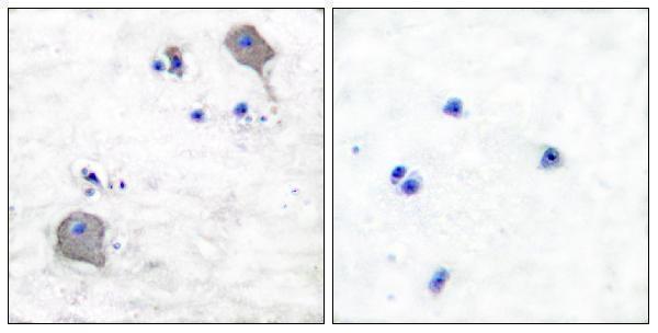 a03260 cldn5 primary antibodies ihc testing 8