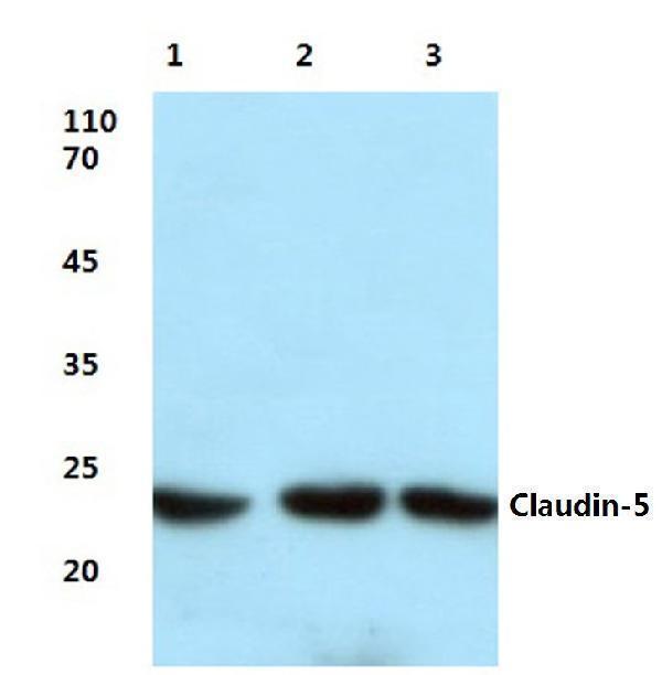 Western blot (WB) analysis of Claudin-5 (S201) polyclonal antibody at 1:500 dilution
Lane1:Hela cell lysate treated with LPS
Lane2:Mouse liver tissue lysate
Lane3:Rat lung tissue lysate