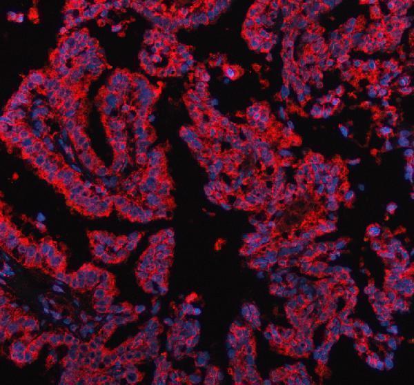 a03261 pdk2 primary antibodies if testing 2
