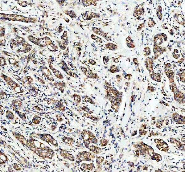IHC analysis of PDK2 using anti-PDK2 antibody (A03261)