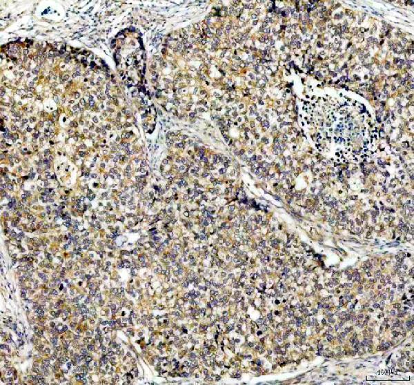 IHC analysis of PDK2 using anti-PDK2 antibody (A03261)