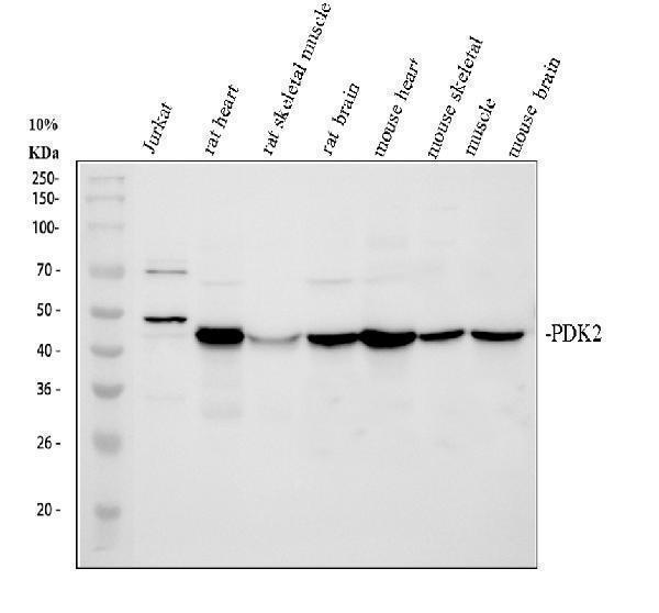 Western blot analysis of PDK2 using anti-PDK2 antibody (A03261)