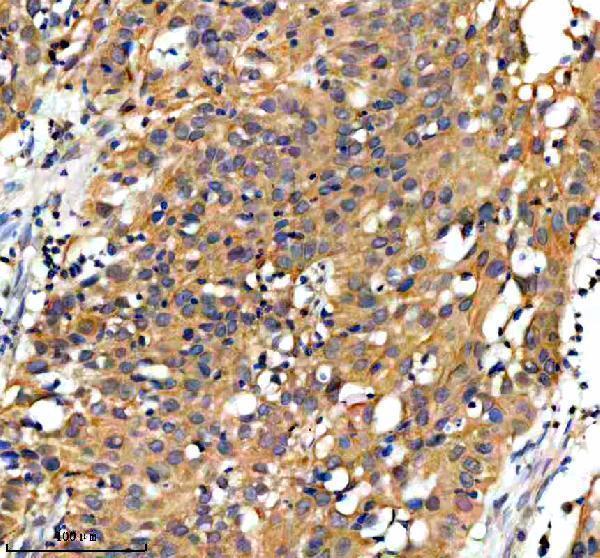  IHC analysis of GPD1 using anti-GPD1 antibody (A03262-1)