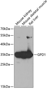 a03262 gpd1 primary antiboties wb testing 1