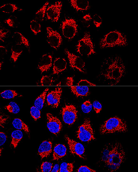 Confocal immunofluorescence analysis of Hela cells using LRPPRC Polyclonal Antibody  at dilution of 1:400