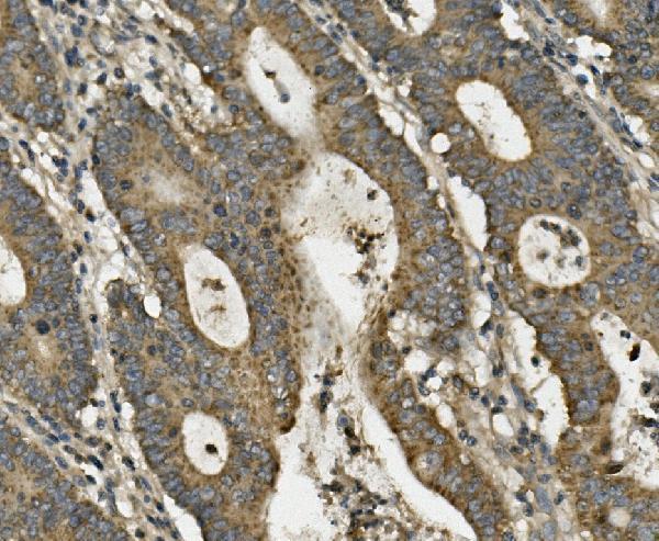a03264 lrpprc primary antibodies ihc testing 2
