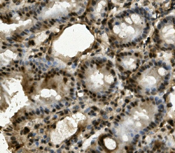 a03264 lrpprc primary antibodies ihc testing 3