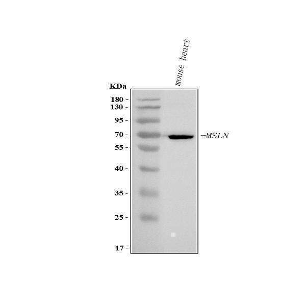  Western blot analysis of Mesothelin/Msln using anti-Mesothelin/Msln antibody (A03266-1)