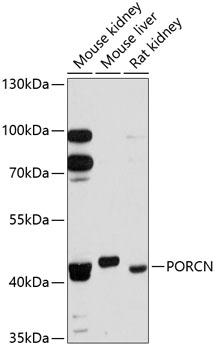 Western blot analysis of extracts of various cell lines, using PORCN antibody  at 1:3000 dilution