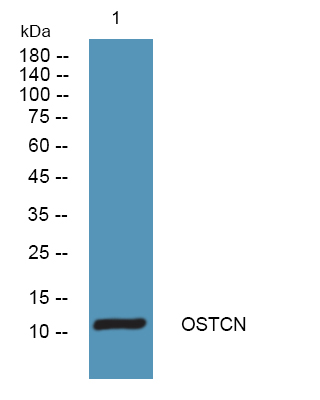 Western blot analysis of lysates from KB cells, primary antibody was diluted at 1:1000, 4°over night