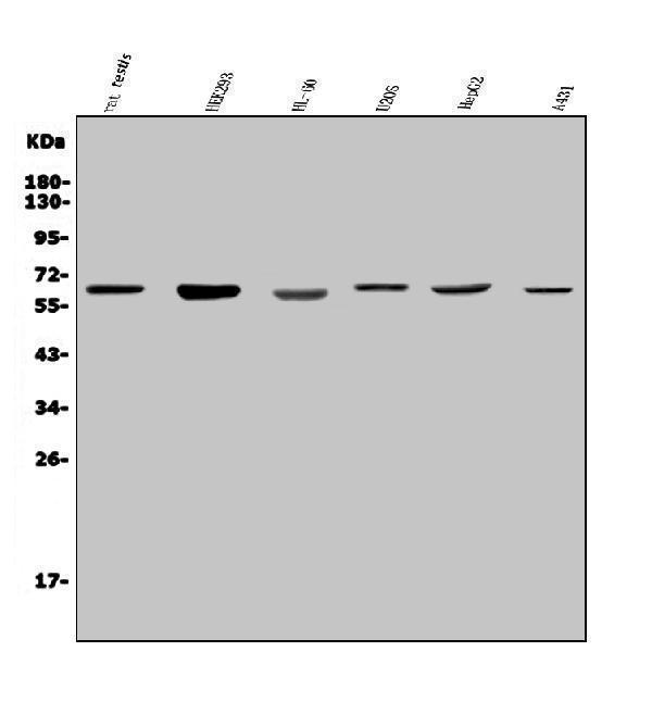 a03270 2 parp2 primary antibodies wb testing 1