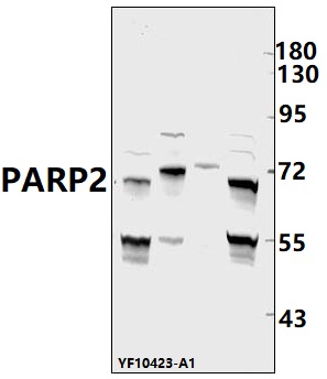 Western blot (WB) analysis of PARP2 pAb at 1:1000 dilution
Lane1:SHSY5Y whole cell lysate(40ug)
Lane2:U-87MG whole cell lysate(40ug)
Lane3:The heart tissue lysate of Rat(40ug)
Lane4:H9C2 whole cell lysate(40ug)
