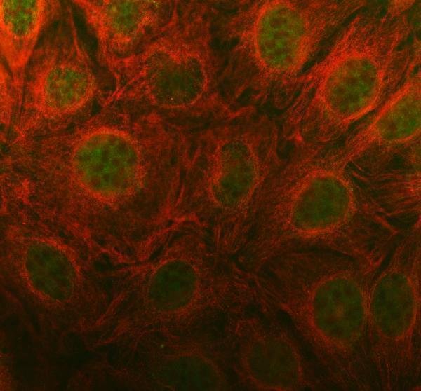 IF analysis of PRM1 using anti-PRM1 antibody (A03274) and anti-Alpha Tubulin antibody (M03989-3)