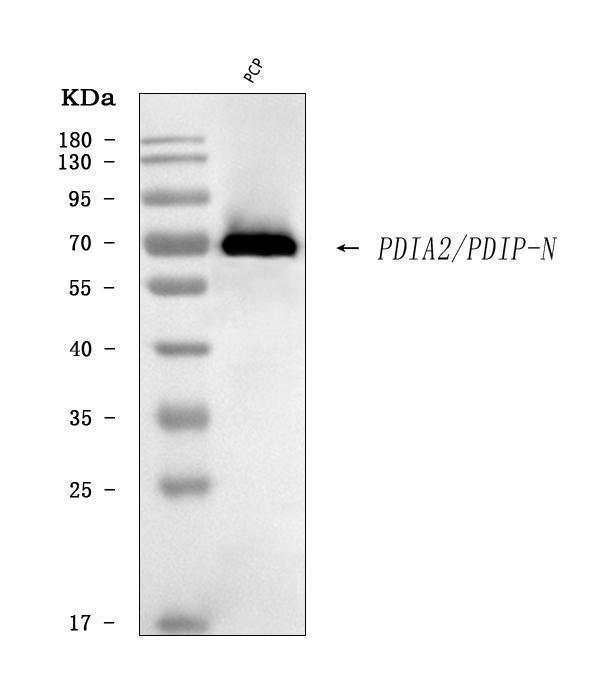  Western blot analysis of PDIP/PDIA2 using anti-PDIP/PDIA2 antibody (A03275-1)