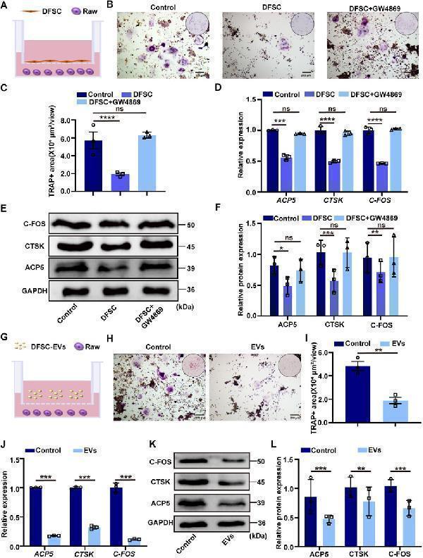 DFSC-EVs regulated tooth eruption by inhibiting osteoclast differentiation