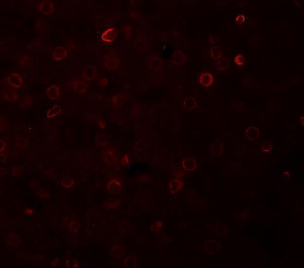 a03277 acp5 primary antibodies if testing 2