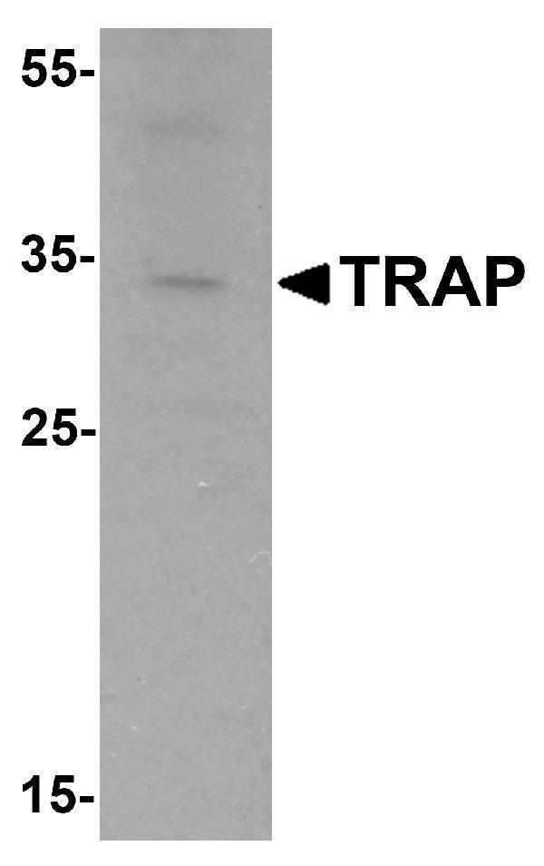 a03277 acp5 primary antibodies wb testing 1