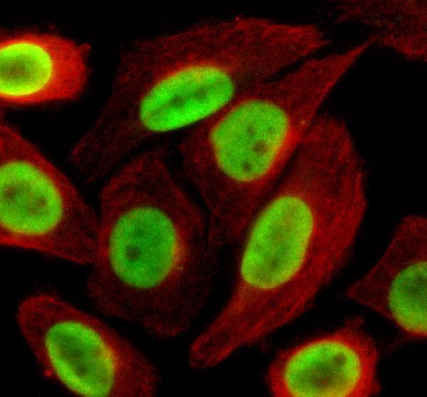 IF analysis of LAP2/TMPO using anti-LAP2/TMPO antibody (A03278-2) and anti-Alpha Tubulin antibody (M03989-3)