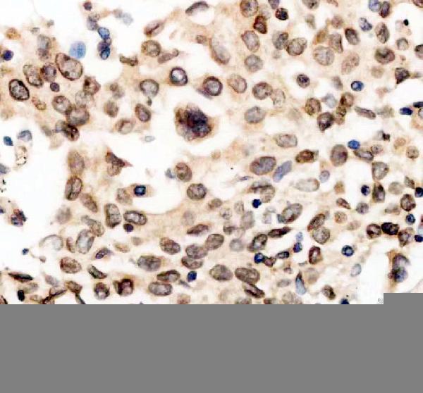 IHC analysis of LAP2/TMPO using anti-LAP2/TMPO antibody (A03278-2)