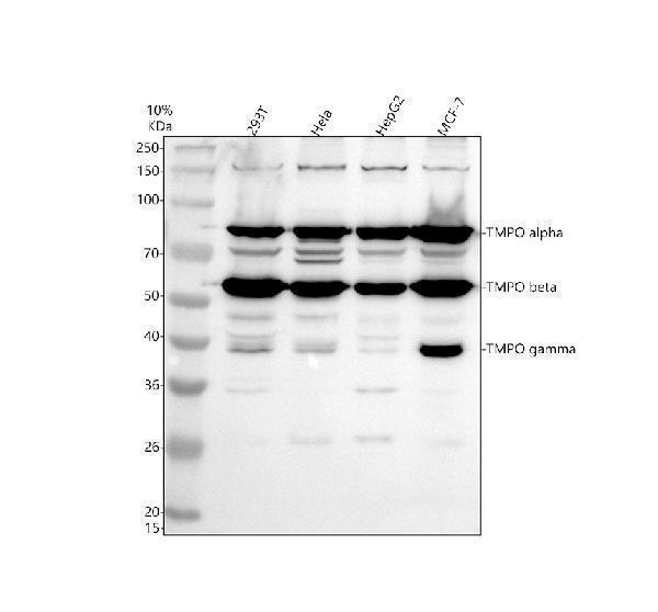 Western blot analysis of LAP2/TMPO using anti-LAP2/TMPO antibody (A03278-2)
