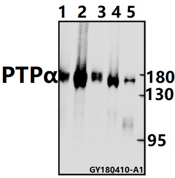 Western blot (WB) analysis of PTPα (I792) pAb at 1:500 dilution
Lane1:C6 whole cell lysate(40ug)
Lane2:CT26 whole cell lysate(40ug)
Lane3:The Heart tissue lysate of Rat(40ug)
Lane4:Panc1 whole cell lysate(20ug)
Lane5:Hela whole cell lysate(20ug)