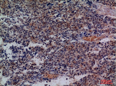 a03281 2 cd48 primary antibodyes ihc testing 3