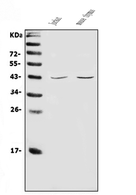  Western blot analysis of CD48 using anti-CD48 antibody (A03281-3)