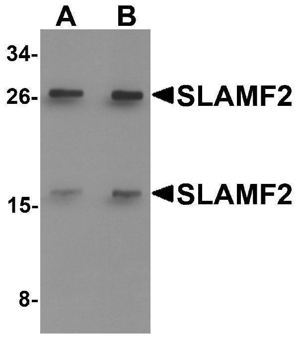 Western blot analysis of SLAMF2 in rat lung tissue lysate with SLAMF2 antibody at (A) 1 and (B) 2 μg/mL