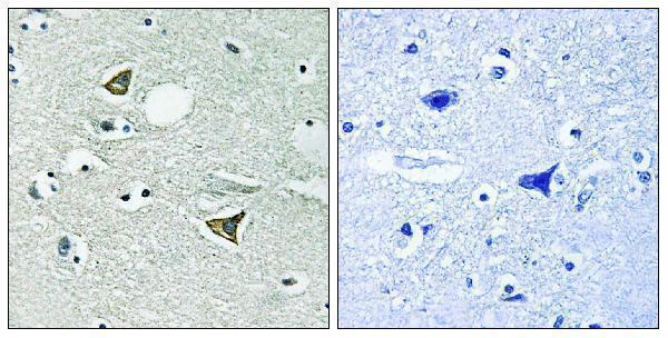 Immunohistochemistry analysis of paraffin-embedded human brain tissue, using Girdin Antibody