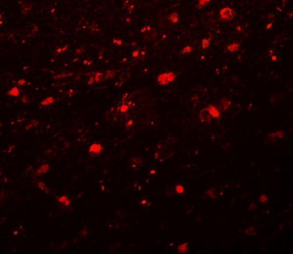 Immunofluorescence of Girdin in human brain tissue with Girdin antibody at 20 μg/mL